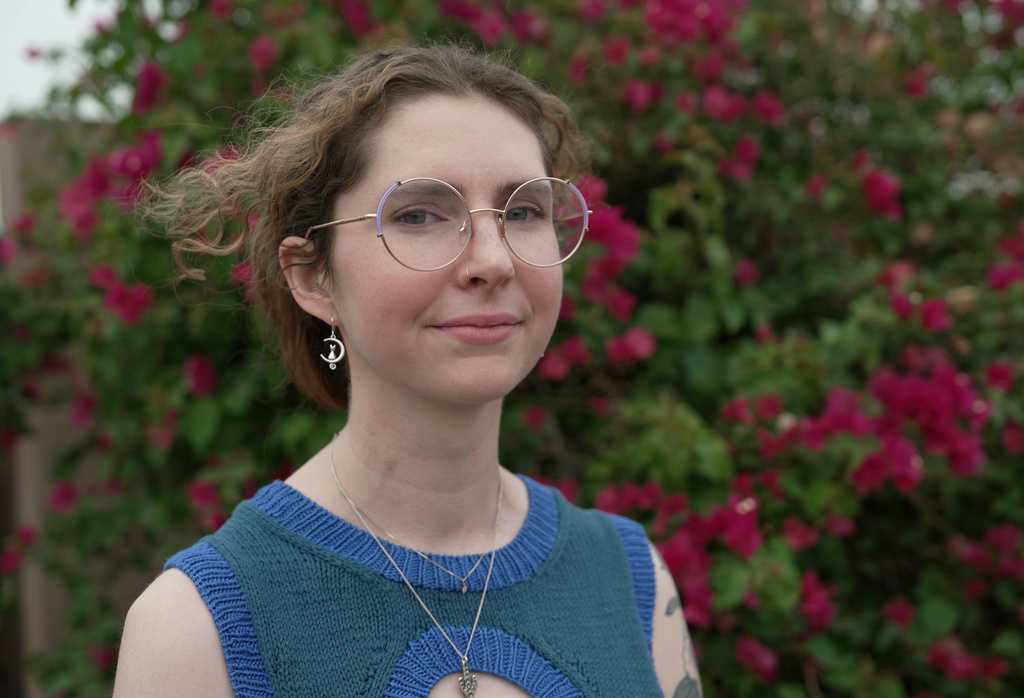 Arizona woman's 3-year wait for an intestine shows the US organ transplant system's complexity — WESH 2 Orlando