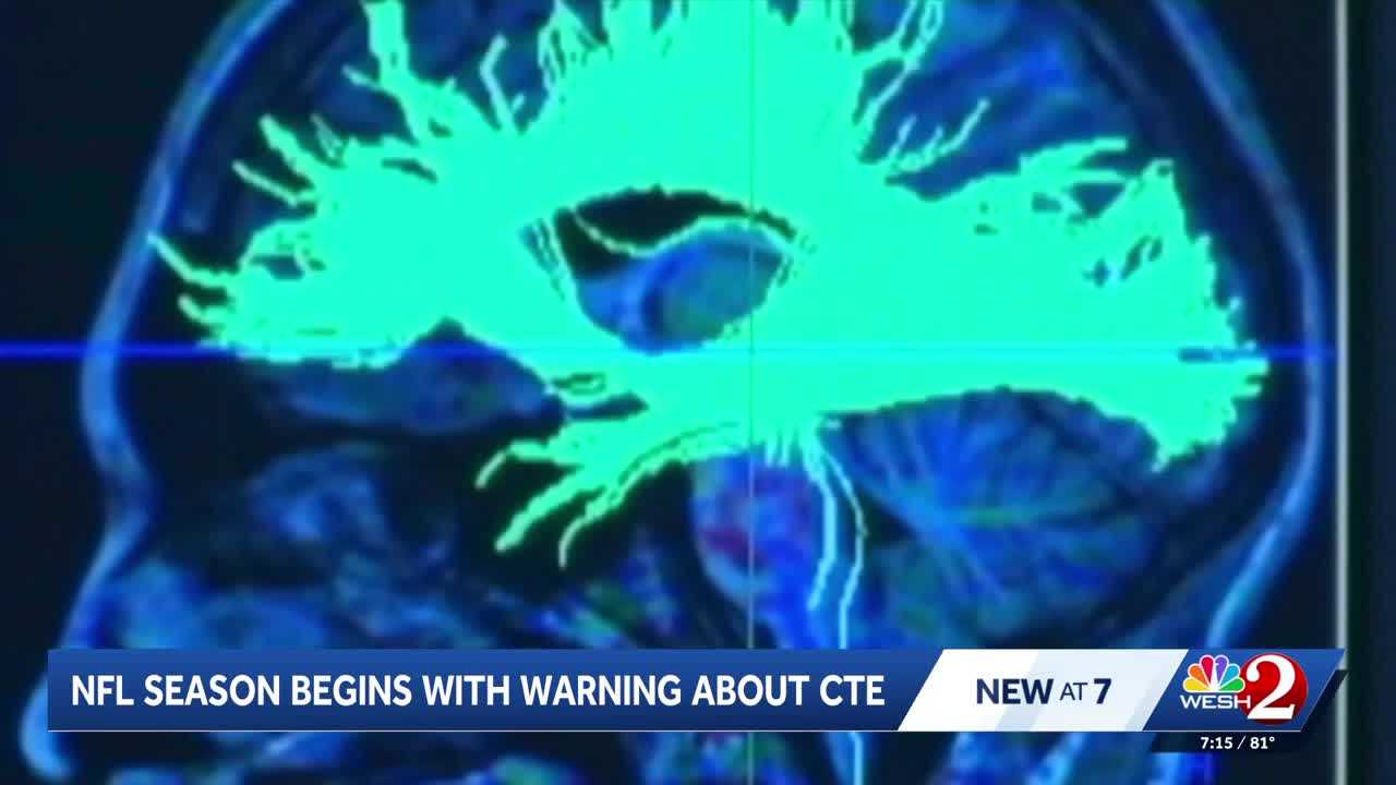 Former NFL player and neurosurgeon addresses CTE concerns and youth football safety — WESH 2 Orlando, Altamonte Springs Sports news